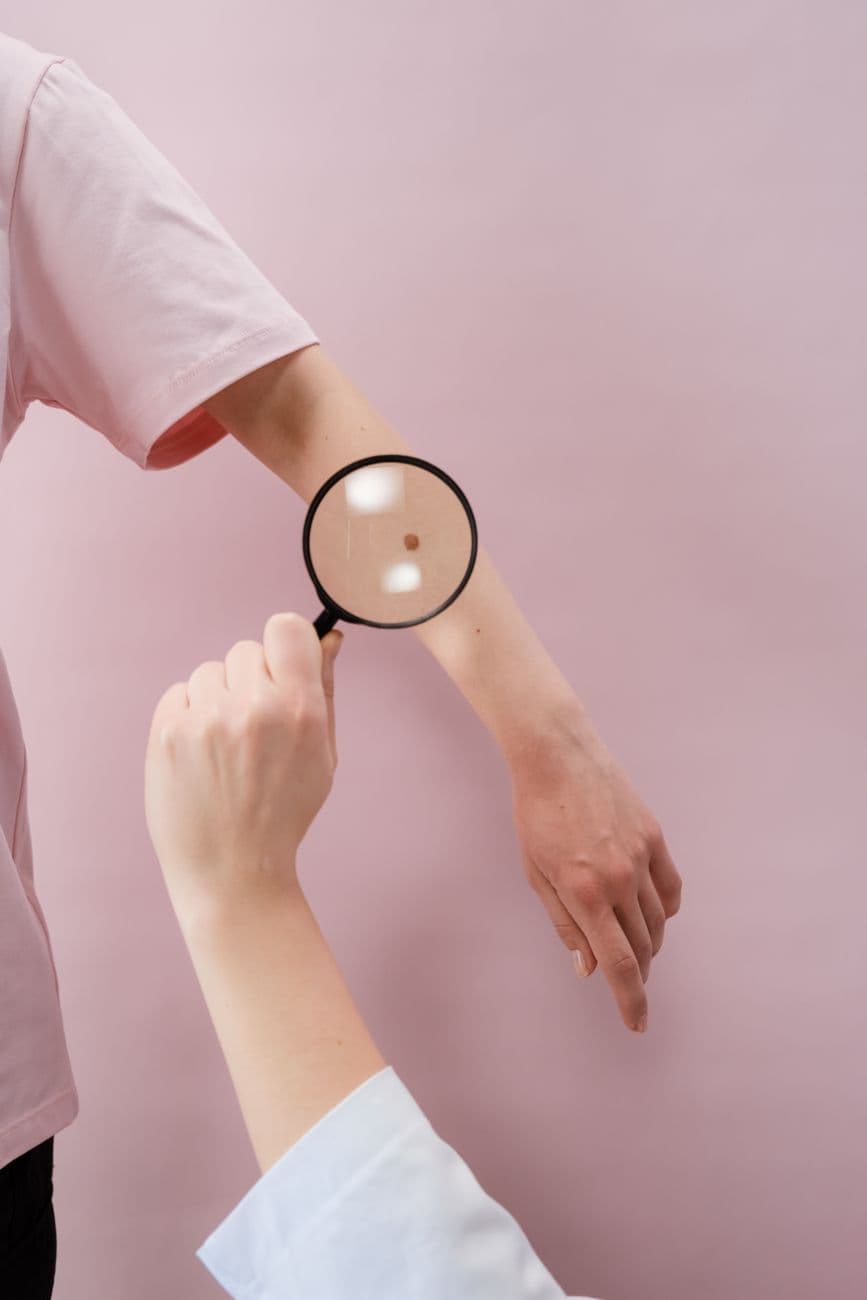 Close-up of a dermatologist examining skin with a magnifier on a pink background.